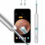 Умная ушная палочка Bebird R1 Smart Visual Spoon Ear Stick белая